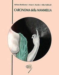 Carcinoma della mammella - Librerie.coop