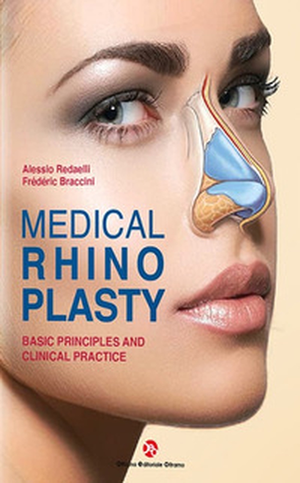 Medical rhinoplasty. Basic principles and clinical practice - Librerie.coop