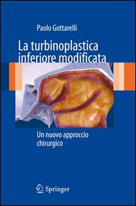 La turbinoplastica inferiore modificata. Un nuovo approccio chirurgico - Librerie.coop