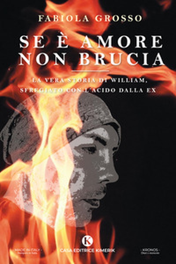 Se è amore non brucia. La vera storia di William, sfregiato con l'acido dalla ex - Librerie.coop Se è amore non brucia. La vera storia di William, sfregiato con l'acido dalla ex - Librerie.coop