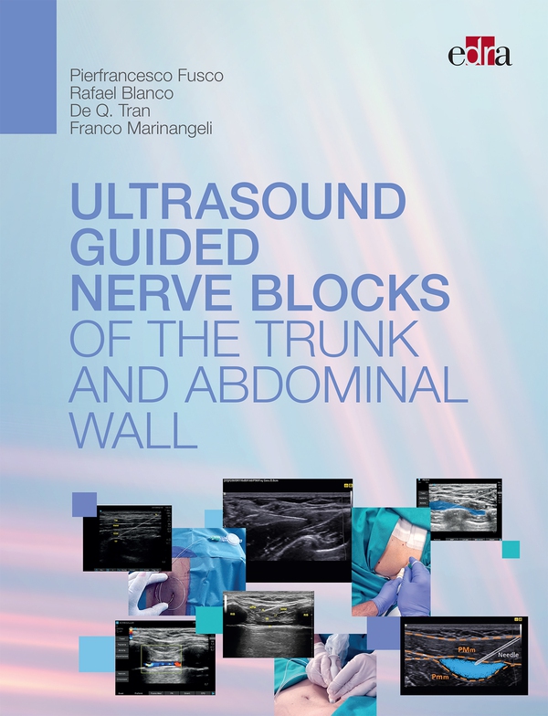Ultrasoundguided nerve blocks of the trunk and abdominal wall - Librerie.coop Ultrasoundguided nerve blocks of the trunk and abdominal wall - Librerie.coop