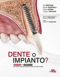 Dente o impianto? - Librerie.coop