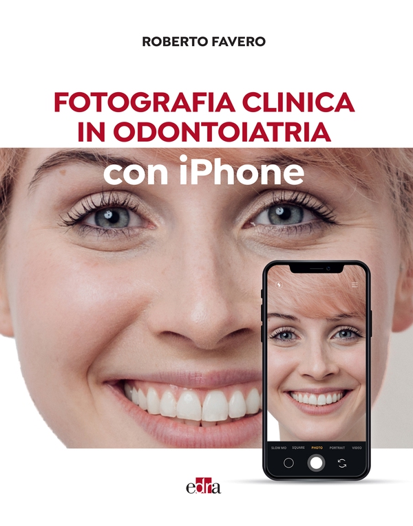 Fotografia clinica in odontoiatria con iPhone - Librerie.coop Fotografia clinica in odontoiatria con iPhone - Librerie.coop