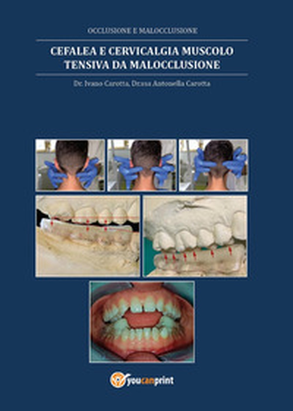 Cefalea e cervicalgia muscolo tensiva da malocclusione - Librerie.coop Cefalea e cervicalgia muscolo tensiva da malocclusione - Librerie.coop