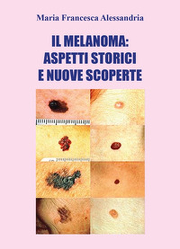 Il melanoma: aspetti storici e nuove scoperte - Librerie.coop Il melanoma: aspetti storici e nuove scoperte - Librerie.coop
