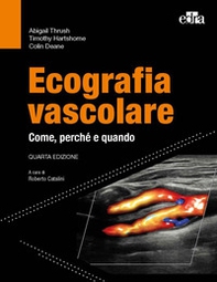 Ecografia vascolare. Come, perché e quando - Librerie.coop