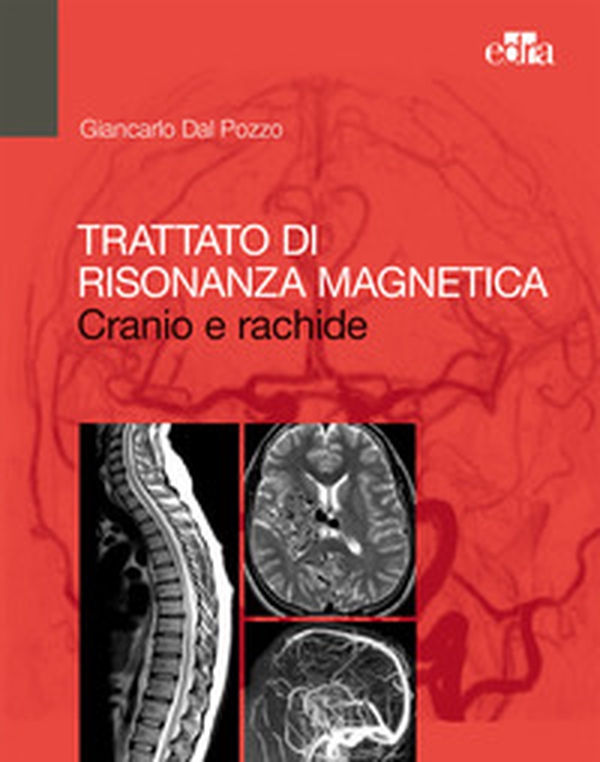 Trattato di risonanza magnetica. Cranio e rachide - Librerie.coop Trattato di risonanza magnetica. Cranio e rachide - Librerie.coop