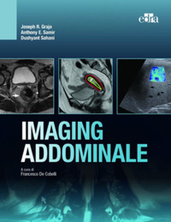 Imaging addominale - Librerie.coop Imaging addominale - Librerie.coop
