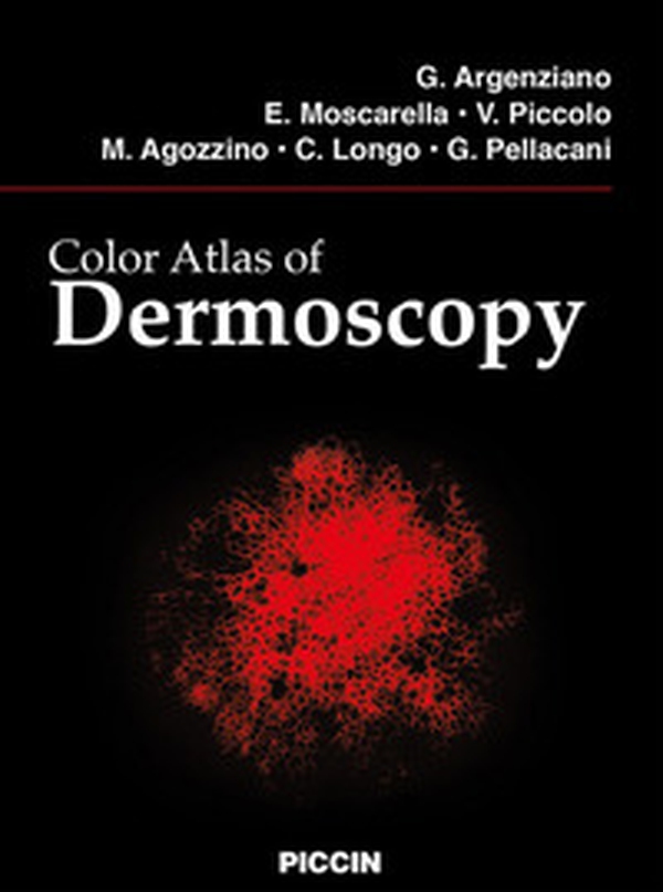 Color atlas of dermoscopy - Librerie.coop Color atlas of dermoscopy - Librerie.coop
