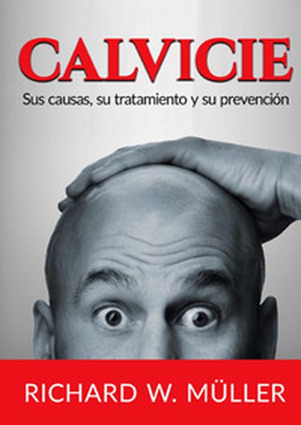 Calvicie. Sus causas, su tratamiento y su prevención - Librerie.coop Calvicie. Sus causas, su tratamiento y su prevención - Librerie.coop