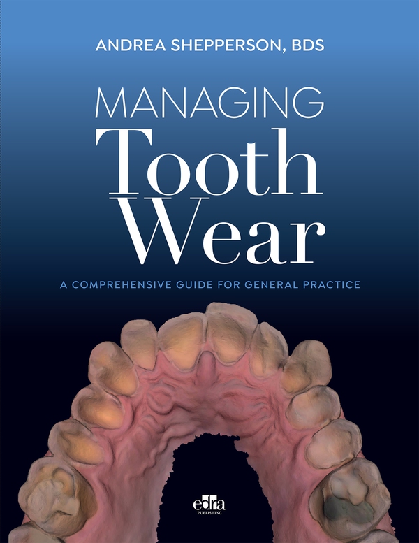 Managing Tooth Wear - Librerie.coop Managing Tooth Wear - Librerie.coop