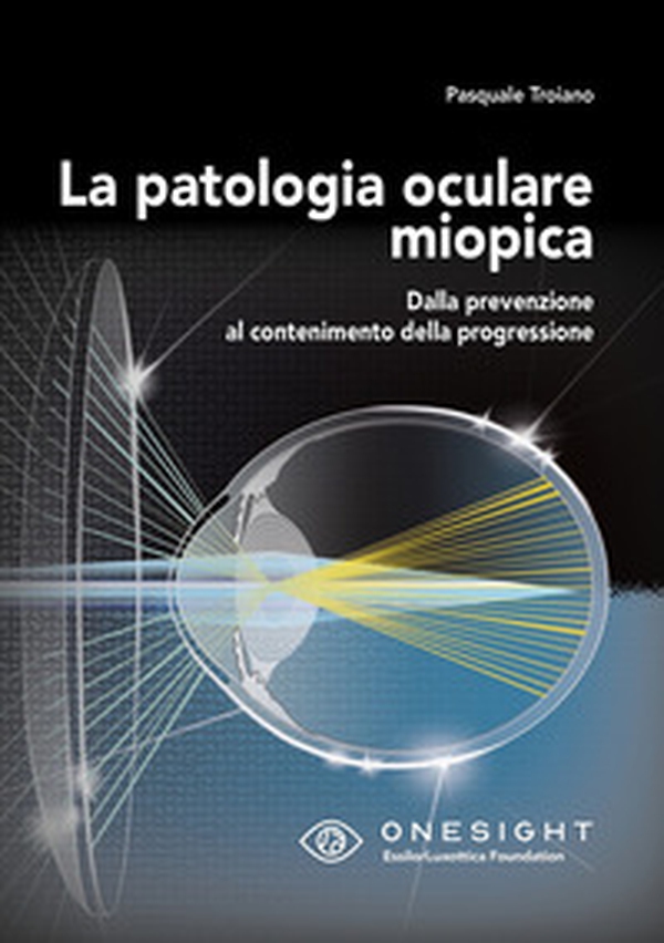 La patologia oculare miopica. Dalla prevenzione al contenimento della progressione - Librerie.coop