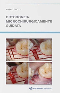 Ortodonzia microchirurgicamente guidata - Librerie.coop