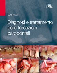 Diagnosi e trattamento delle forcazioni parodontali - Librerie.coop
