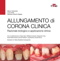 ALLUNGAMENTO DI CORONA CLINICA - Librerie.coop