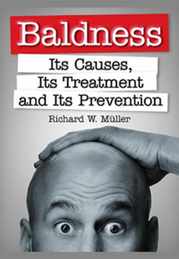 Baldness. Its causes, its treatment and its prevention - Librerie.coop Baldness. Its causes, its treatment and its prevention - Librerie.coop