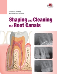 Shaping and  Cleaning the Root Canals - Librerie.coop Shaping and  Cleaning the Root Canals - Librerie.coop