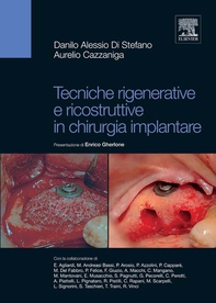 Tecniche rigenerative e ricostruttive in chirurgia implantare - Librerie.coop
