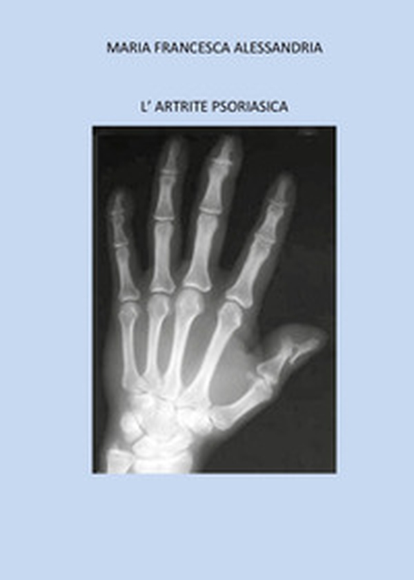 L'artrite psoriasica - Librerie.coop L'artrite psoriasica - Librerie.coop