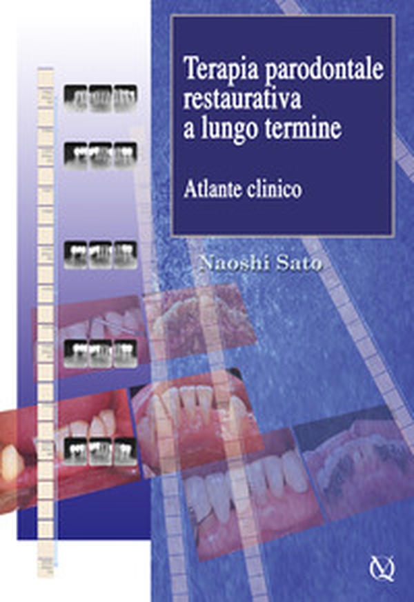 Terapia parodontale restaurativa a lungo termine. Atlante clinico - Librerie.coop Terapia parodontale restaurativa a lungo termine. Atlante clinico - Librerie.coop
