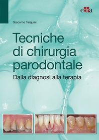 Tecniche di chirurgia parodontale. Dalla diagnosi alla terapia - Librerie.coop