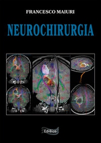 Neurochirurgia - Librerie.coop
