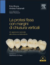 La protesi fissa con margini di chiusura verticali - Librerie.coop