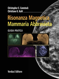 Risonanza magnetica mammaria abbreviata. Guida pratica - Librerie.coop