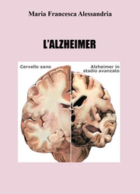 L'azheimer - Librerie.coop