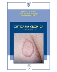 Orticaria cronica - Librerie.coop