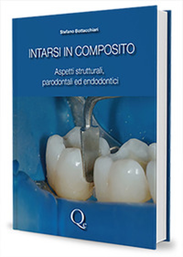 Intarsi in composito. Aspetti strutturali, parodontali ed endodontici - Librerie.coop Intarsi in composito. Aspetti strutturali, parodontali ed endodontici - Librerie.coop