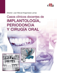 Casos clínicos docentes de IMPLANTOLOGÍA, PERIODONCIA Y CIRUGÍA ORAL - Librerie.coop