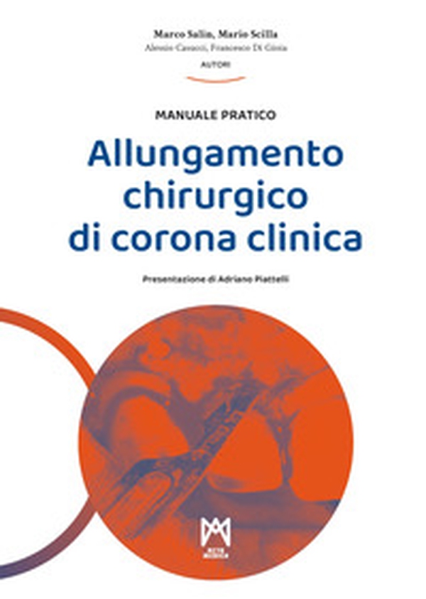 Allungamento chirurgico di corona clinica - Librerie.coop Allungamento chirurgico di corona clinica - Librerie.coop