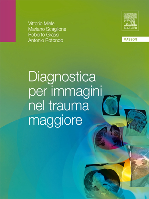 Diagnostica per immagini nel trauma maggiore - Librerie.coop