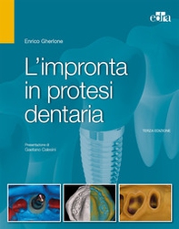 L'impronta in protesi dentaria - Librerie.coop
