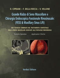 Grande rialzo di seno mascellare e chirurgia endoscopica funzionale rinosinusale. Due tecniche combinate nel trattamento contestuale delle atrofie mascellari associate alle patologie rinosinusali - Librerie.coop