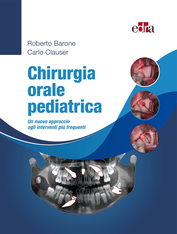 Chirurgia orale pediatrica - Librerie.coop Chirurgia orale pediatrica - Librerie.coop