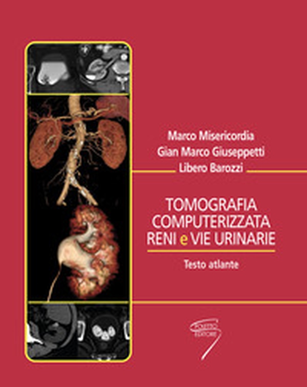 Tomografia computerizzata reni e vie urinarie. Testo atlante - Librerie.coop Tomografia computerizzata reni e vie urinarie. Testo atlante - Librerie.coop