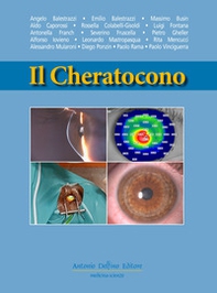 Il cheratocono - Librerie.coop