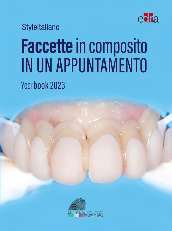 Faccette in composito in un appuntamento - Librerie.coop Faccette in composito in un appuntamento - Librerie.coop
