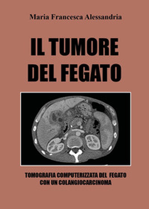 Il tumore del fegato - Librerie.coop Il tumore del fegato - Librerie.coop