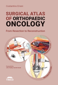 Surgical atlas of orthopaedic oncology. From resection to reconstruction - Librerie.coop
