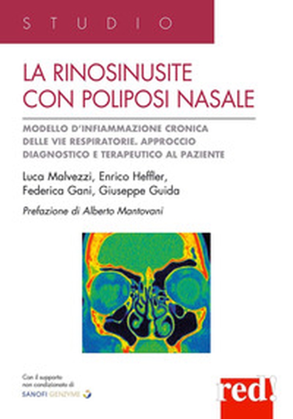 La rinosinusite con poliposi nasale. Modello d'infiammazione cronica delle vie respiratorie. Approccio terapeutico al paziente - Librerie.coop La rinosinusite con poliposi nasale. Modello d'infiammazione cronica delle vie respiratorie. Approccio terapeutico al paziente - Librerie.coop