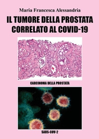 Il tumore alla prostata correlato al Covid-19 - Librerie.coop