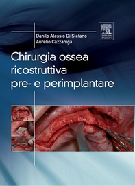 Chirurgia ossea ricostruttiva pre-e perimplantare - Librerie.coop