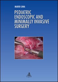 Pediatric endoscopic and minimally invasive surgery - Librerie.coop Pediatric endoscopic and minimally invasive surgery - Librerie.coop