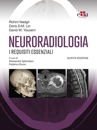 Neuroradiologia - Librerie.coop