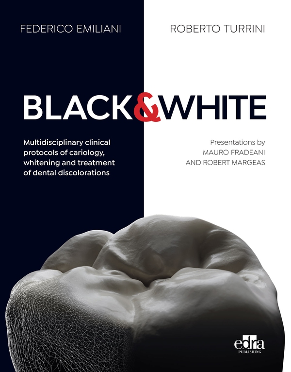 BLACK&WHITE Multidisciplinary clinical protocols of cariology, whitening and treatment of dental discolorations - Librerie.coop BLACK&WHITE Multidisciplinary clinical protocols of cariology, whitening and treatment of dental discolorations - Librerie.coop