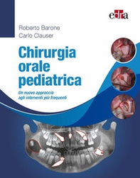 Chirurgia orale pediatrica. Un nuovo approccio agli interventi più frequenti - Librerie.coop