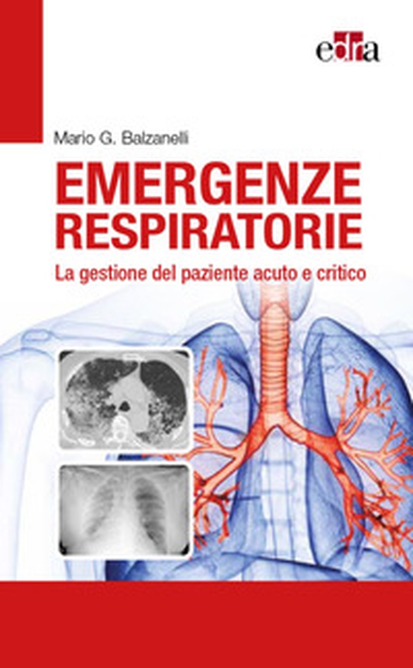 Emergenze respiratorie. La gestione del paziente acuto e critico - Librerie.coop Emergenze respiratorie. La gestione del paziente acuto e critico - Librerie.coop